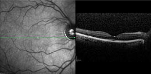 ΠΡΟΣΚΛΗΣΗ ΤΟΥ ΓΡΗΓΟΡΗ ΓΕΩΡΓΑΡΙΟΥ