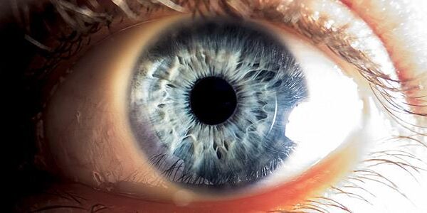 Άρθρο του χειρουργού οφθαλμίατρου κ. Αλέξανδρου Χαρώνη που δημοσιεύθηκε στο Iatronet.